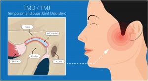tmj treatment services weatherford TX